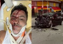 Irmão de Rodrigo Faro sofre acidente de carro em SP: ‘Fiquei inconsciente’