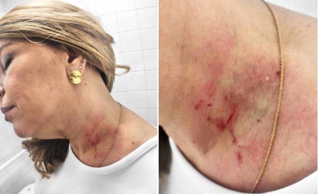 Polícia investigará briga entre vereadoras do Partido Novo na Câmara Municipal de São Paulo