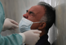 Maior rede de hospitais privados do Brasil limita realização de testes de Covid-19