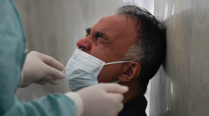 Maior rede de hospitais privados do Brasil limita realização de testes de Covid-19