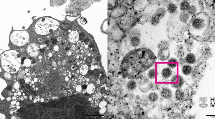 Variante ômicron já corresponde a 50% dos casos de Covid-19 na cidade de São Paulo